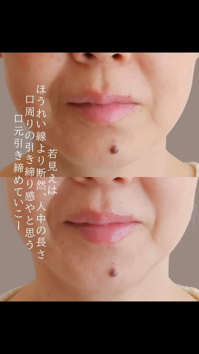 笑顔が一番の若返りだよ😊