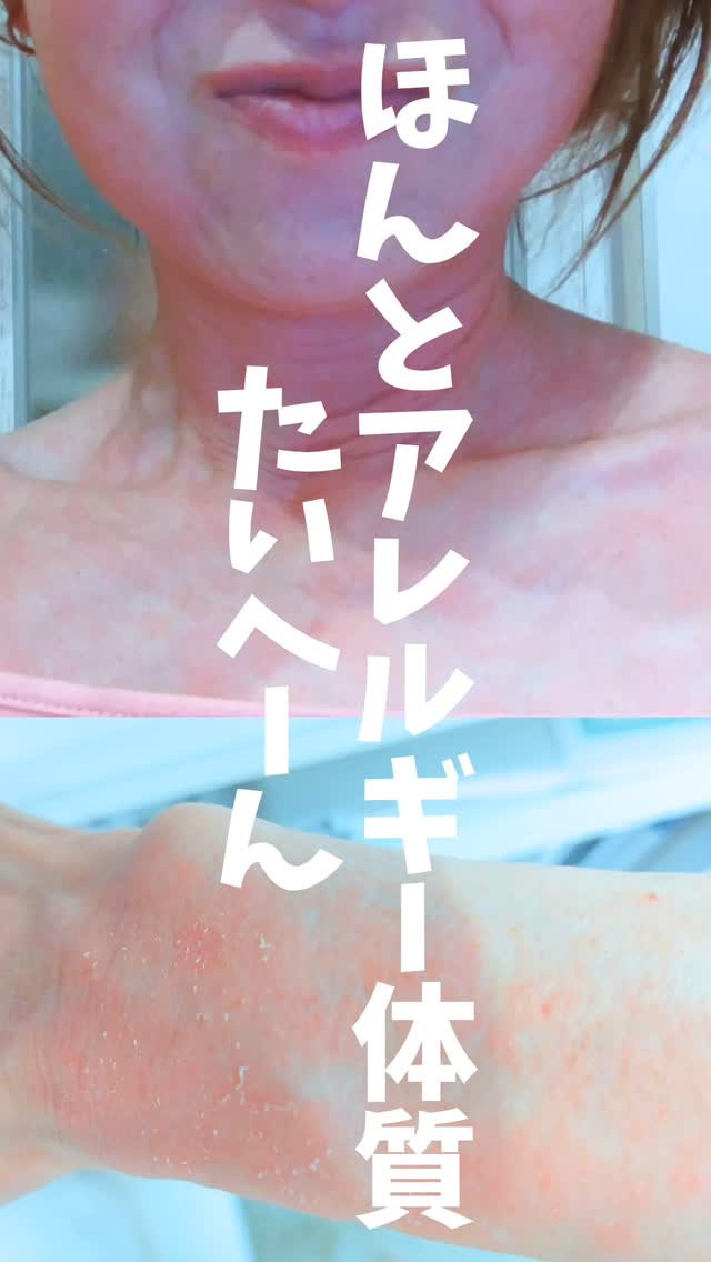 私の肌は、かなり厄介な肌です