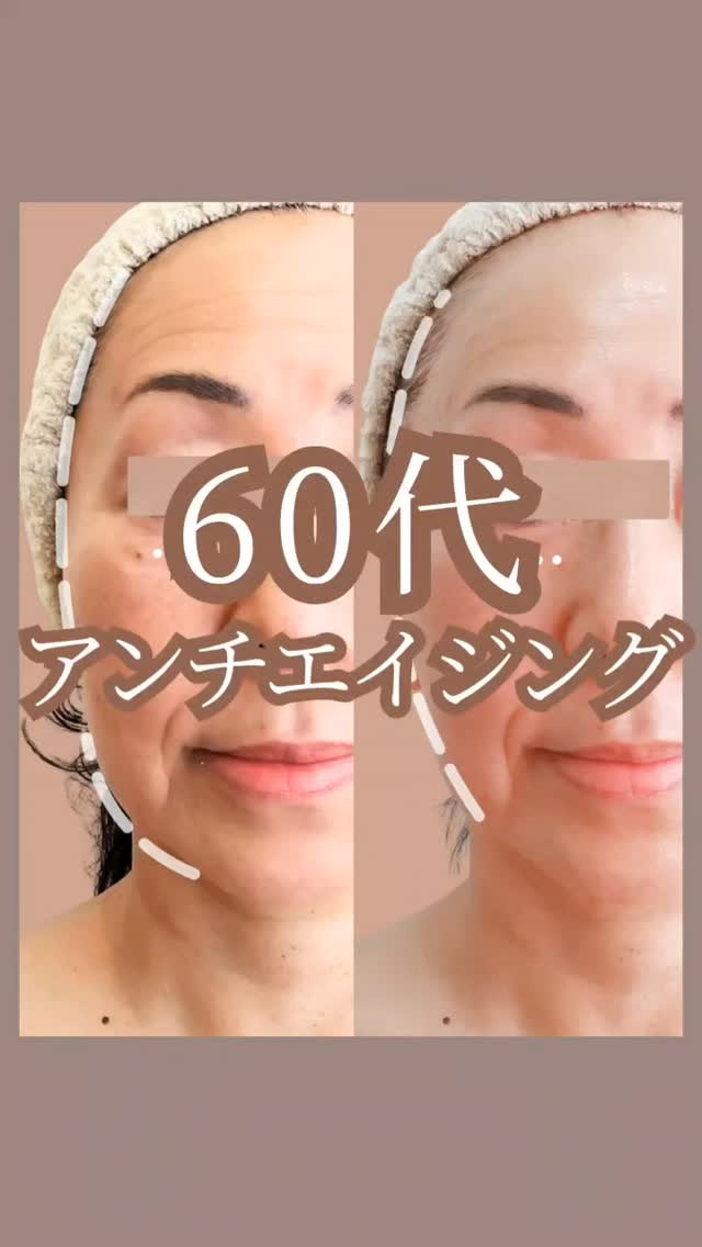 美容整形ではないので、ここまで変わるのに