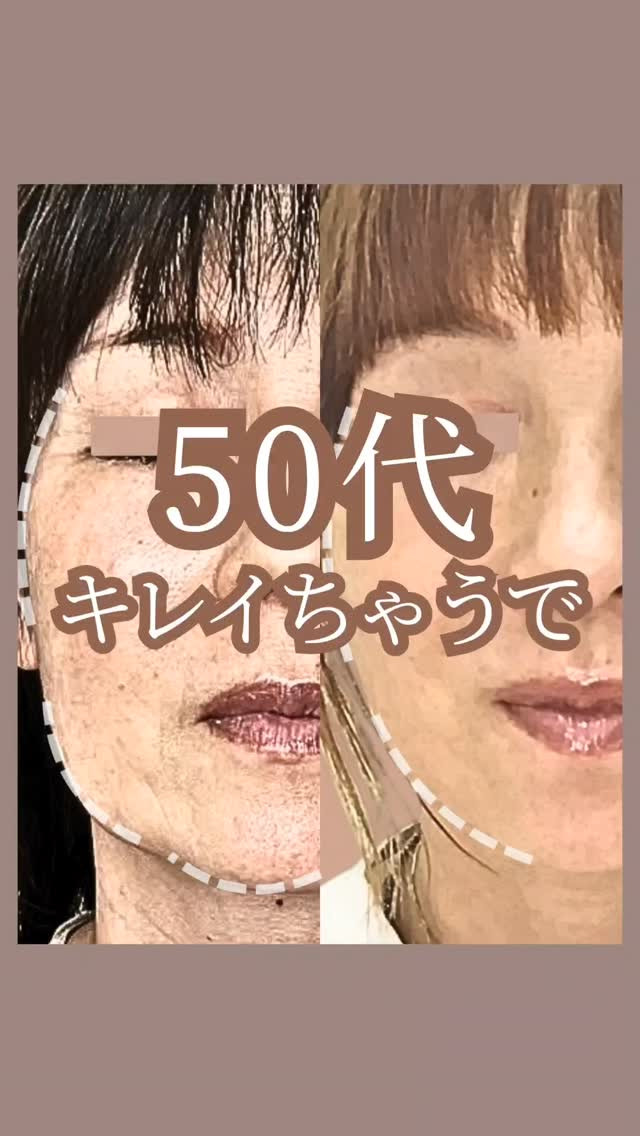 お見苦しい画像ですみません😅